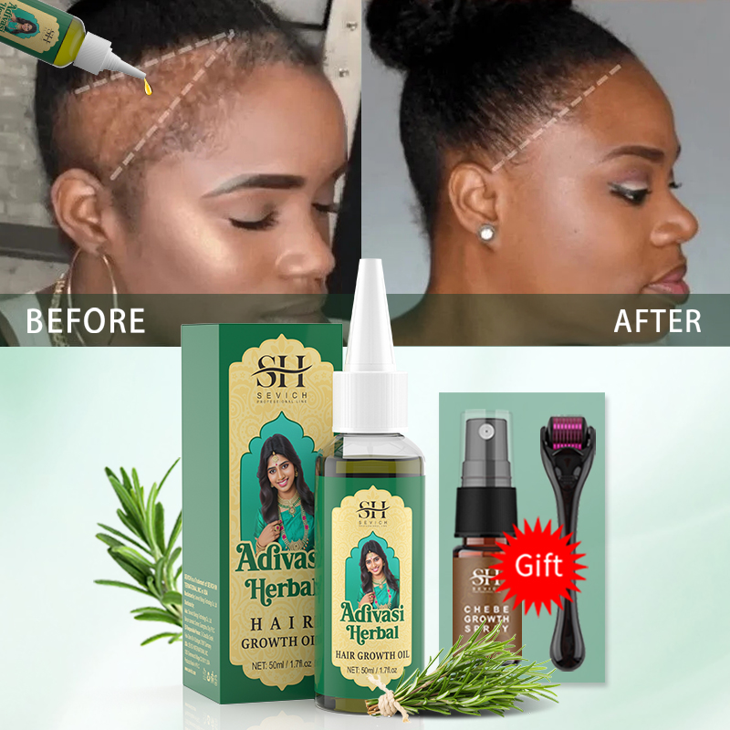Ayurvedisches Haarwuchsöl Indi – Ayurvedic & Herbal Wellness Kits Bewertung und Preis