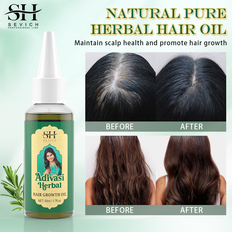 Ayurvedisches Haarwachstumsöl  – Ayurvedic & Herbal Wellness Kits Bewertung und Preis